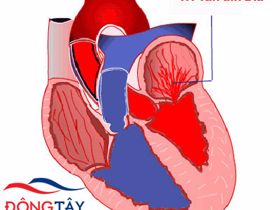 Hở van tim: những điều cần lưu ý để làm tăng hiệu quả điều trị 