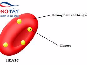 HbA1c có ý nghĩa gì trong bệnh tiểu đường?