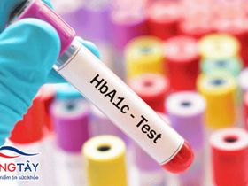 Xét nghiệm HbA1c - Tất cả thông tin người tiểu đường cần biết