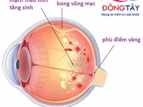 Biến chứng mắt của bệnh tiểu đường – Đâu mới là giải pháp chữa trị hiệu quả?