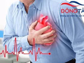 Khám phá lý do tại sao bị rối loạn nhịp tim sau nhồi máu cơ tim