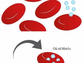 HbA1c - Tiêu chuẩn vàng đánh giá hiệu quả điều trị tiểu đường tuýp 2
