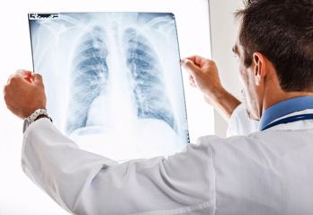 THẮC MẮC: Ung thư phổi di căn có chữa khỏi được không?