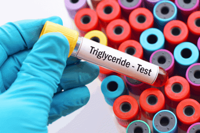 Những điều cần biết về chỉ số Triglyceride