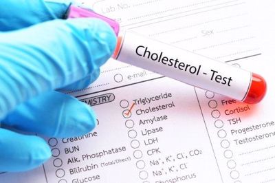 Cholesterol toàn phần là gì? Tìm hiểu ngay!