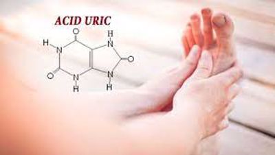 Bị acid uric cao có làm tăng nguy cơ viêm xương khớp?