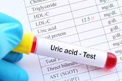 Chỉ số acid uric cảnh báo mức độ nguy hiểm của bệnh gút!