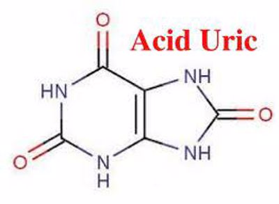 Chứng tăng acid uric có mối liên hệ với nguy cơ đột qụy như thế nào?