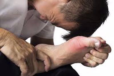 Chườm đá làm giảm chứng đau khớp ở bệnh nhân gút