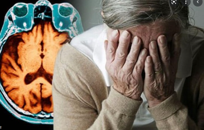 10 dấu hiệu của bệnh alzheimer