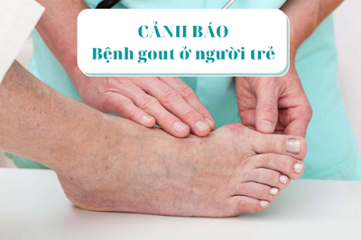 Cảnh báo: Bệnh gout ở người trẻ có xu hướng tăng cao