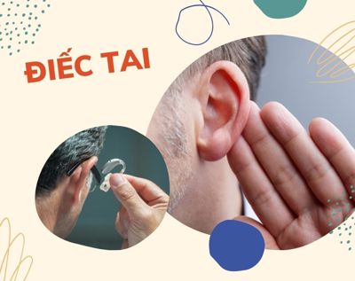 Tổng quan về bệnh điếc tai và những cách điều trị hiệu quả 
