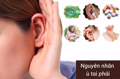 Những nguyên nhân gây ù tai phải và cách điều trị hiệu quả