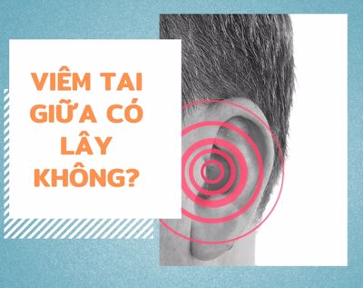 Viêm tai giữa có lây không? Điều trị thế nào cho hiệu quả?