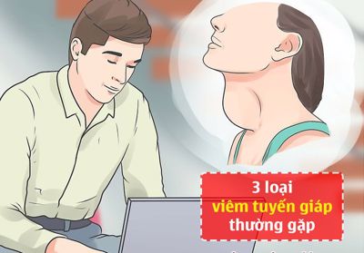 Điểm mặt 3 loại viêm tuyến giáp thường gặp