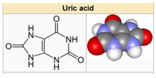 Nguyên nhân và biến chứng cuả tăng caid uric máu