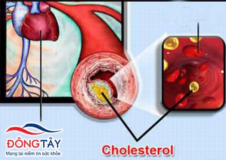 Cholesterol máu
