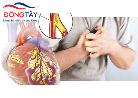 Đau thắt ngực là triệu chứng phổ biến khi bị bệnh tim mạch do tiểu đường