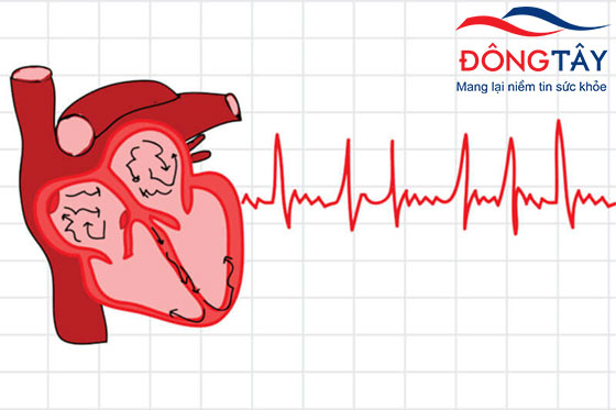 Rung nhĩ có thể khiến tim bạn đập trên 200 nhịp/phút