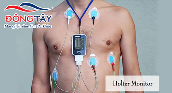 Thiết bị Holer đo nhịp tim trong 24h giúp phát hiện ngoại tâm thu