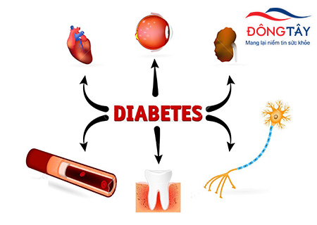 Biến chứng tiểu đường “hủy diệt” hầu hết cơ quan trong cơ thể